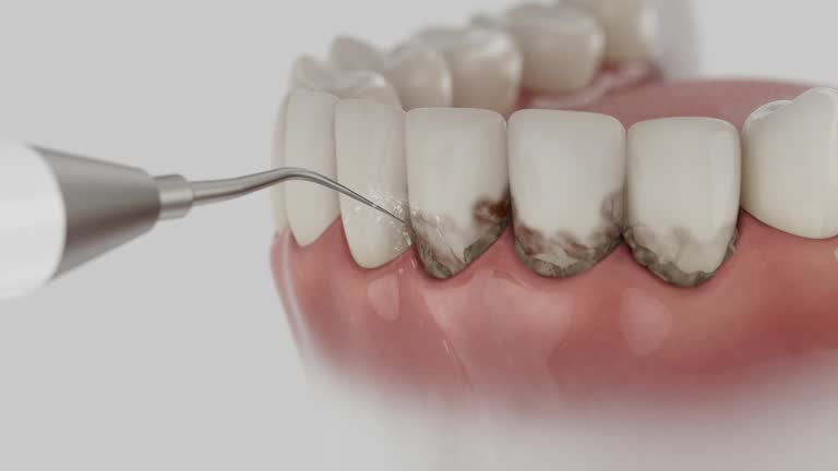 Reliable Emergency Dentist contractor in Runaway Bay, TX by Smile Center Dentistry